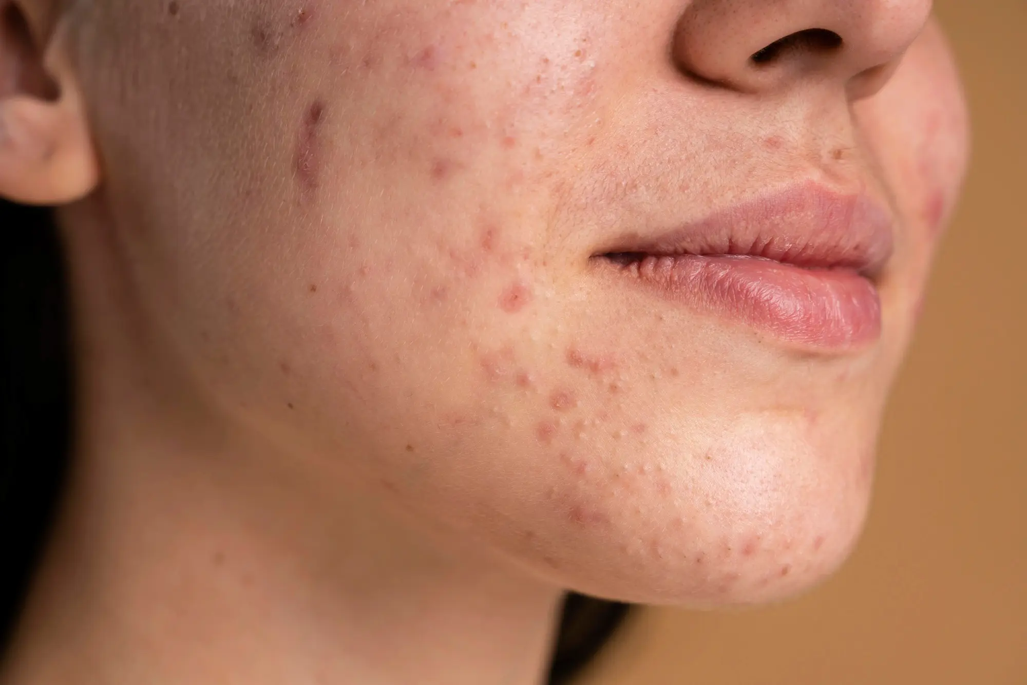 is my skincare working