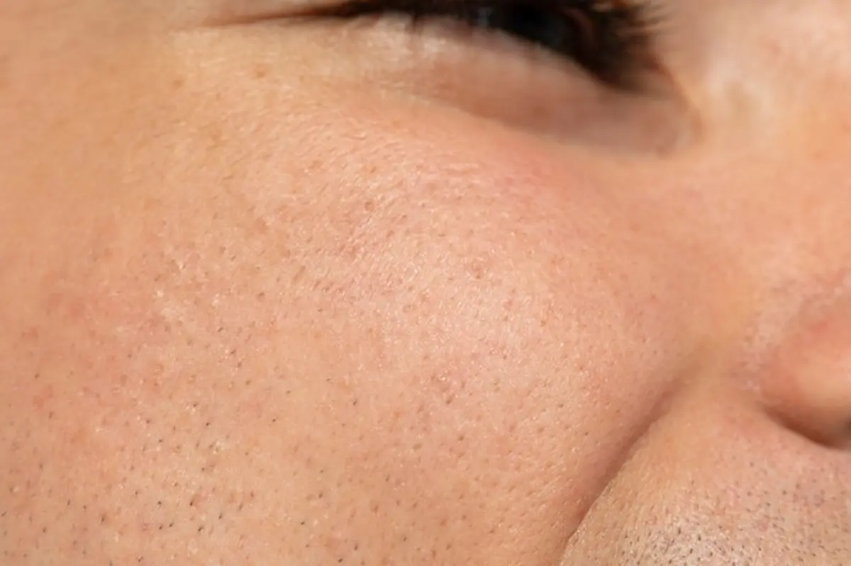collagen for dry skin