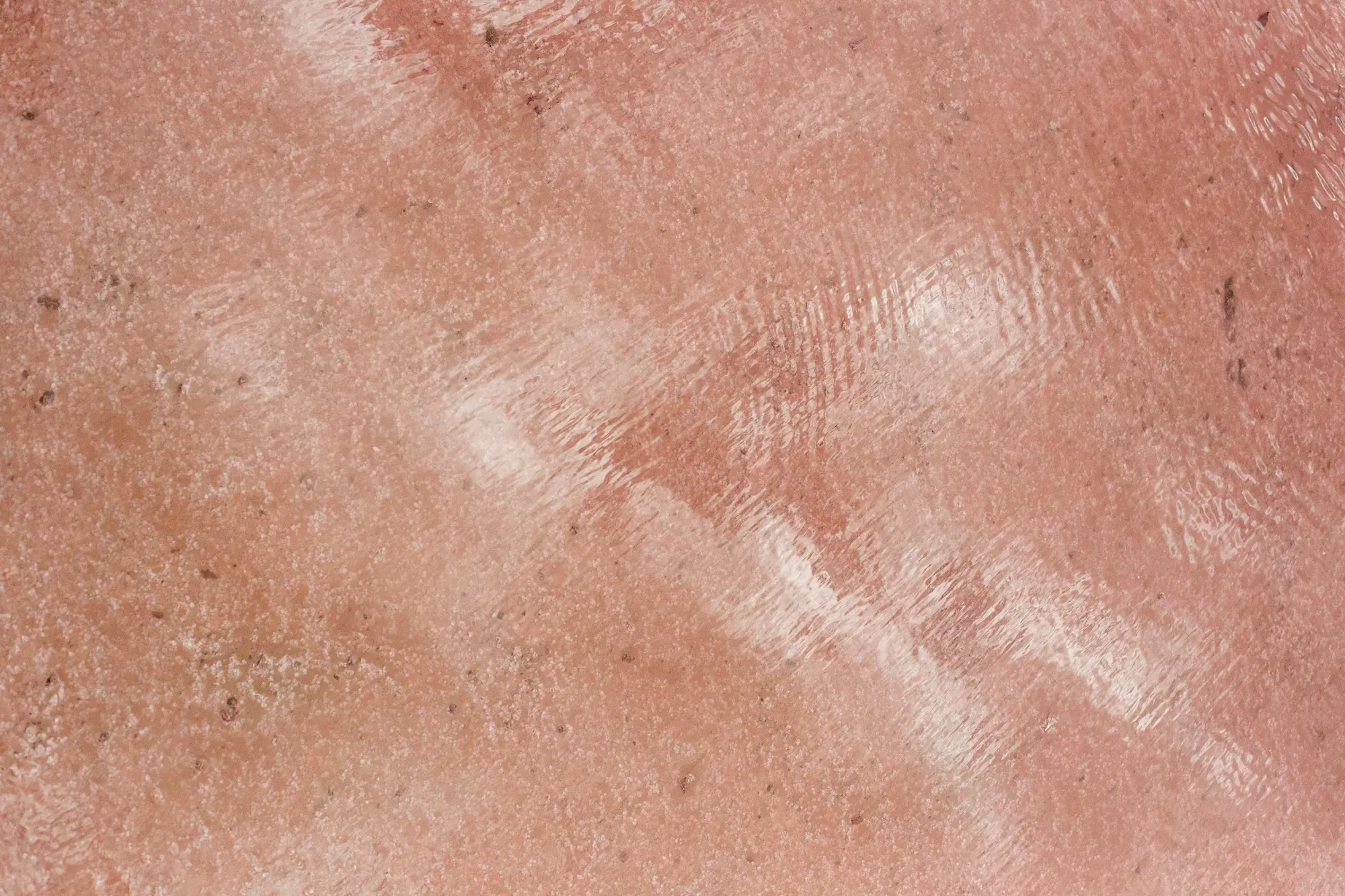 acid mantle skin