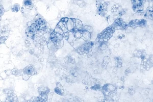 skin microbiome what is and why it matters