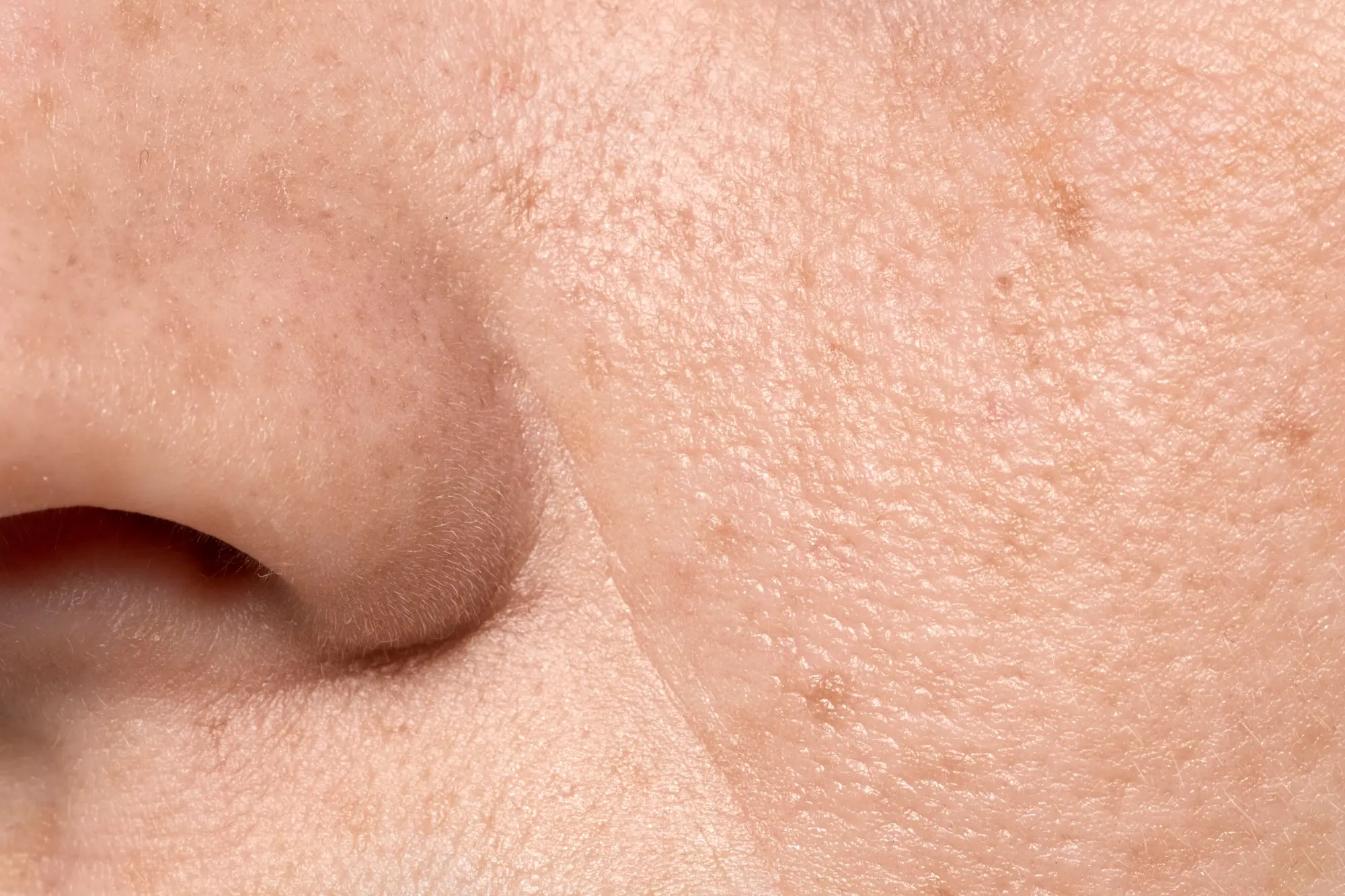 what are pores and why they clog