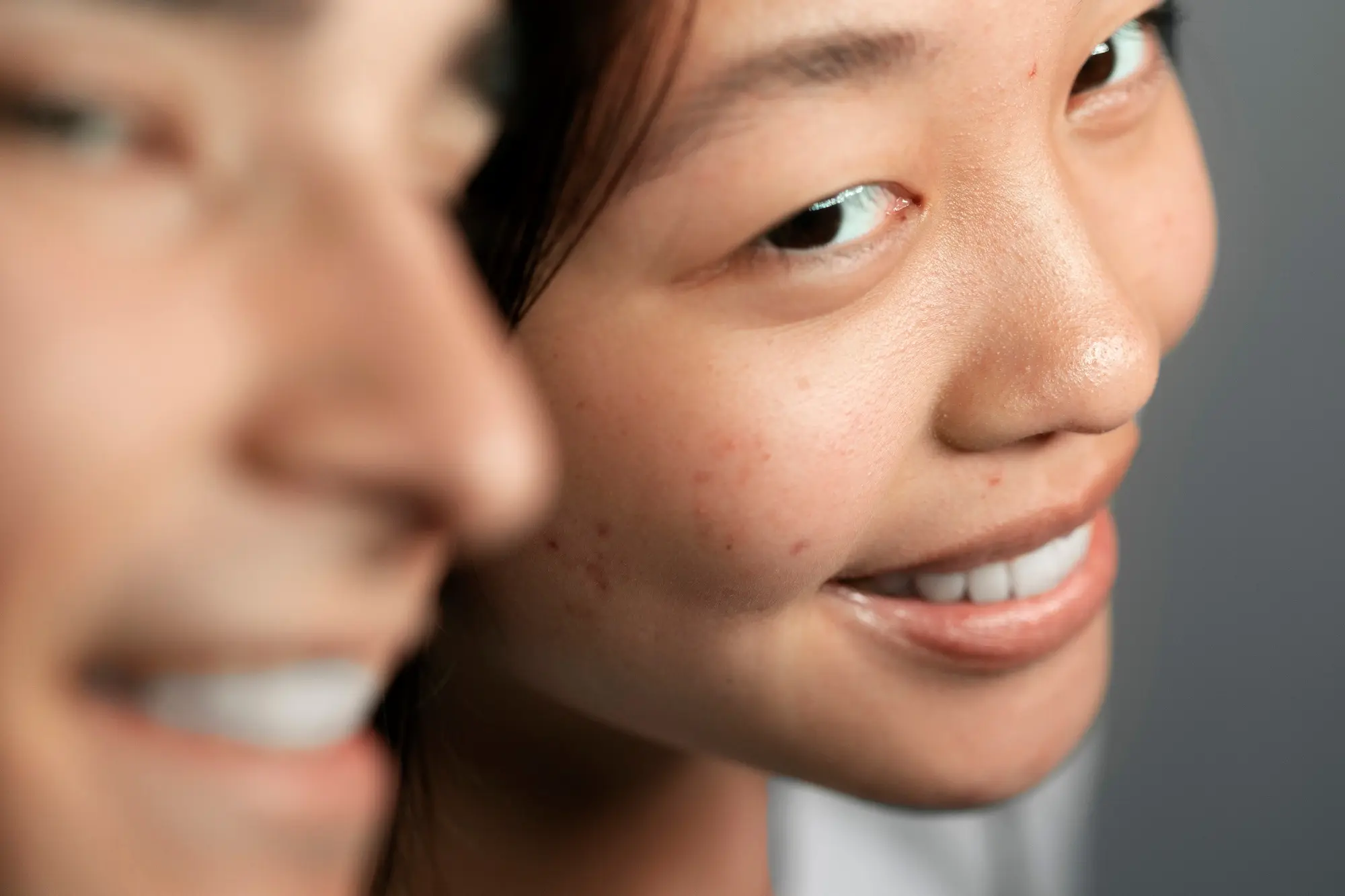 dark spots on face