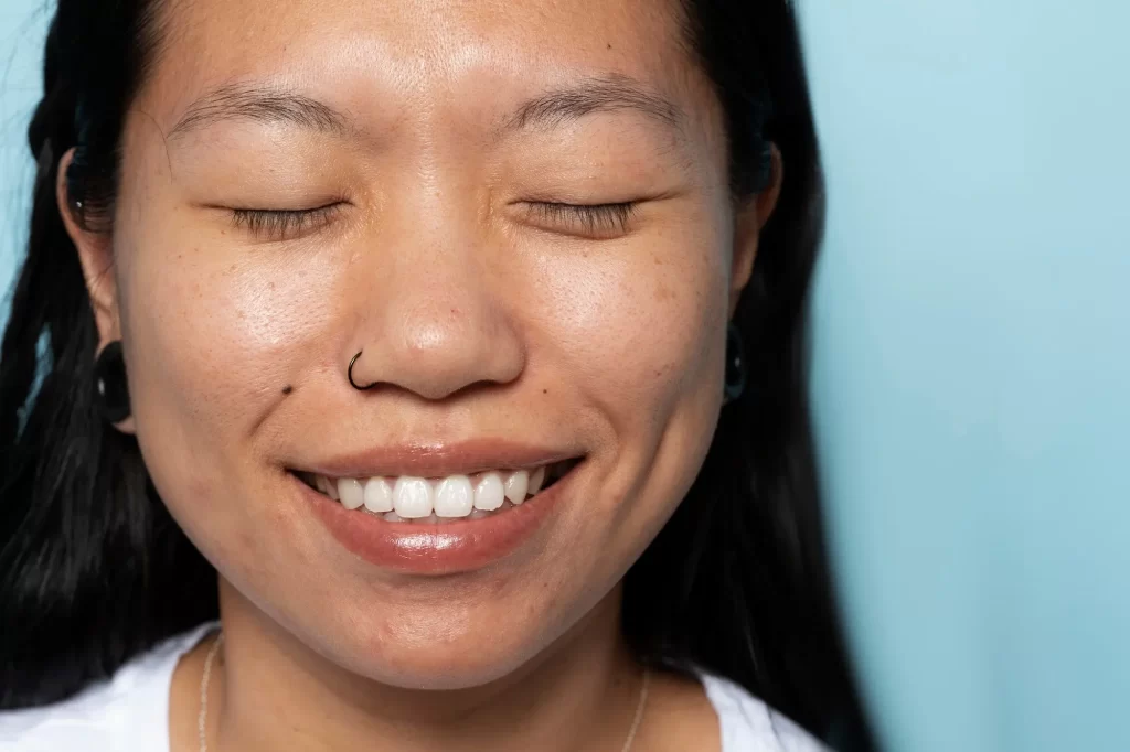 dark spots on face