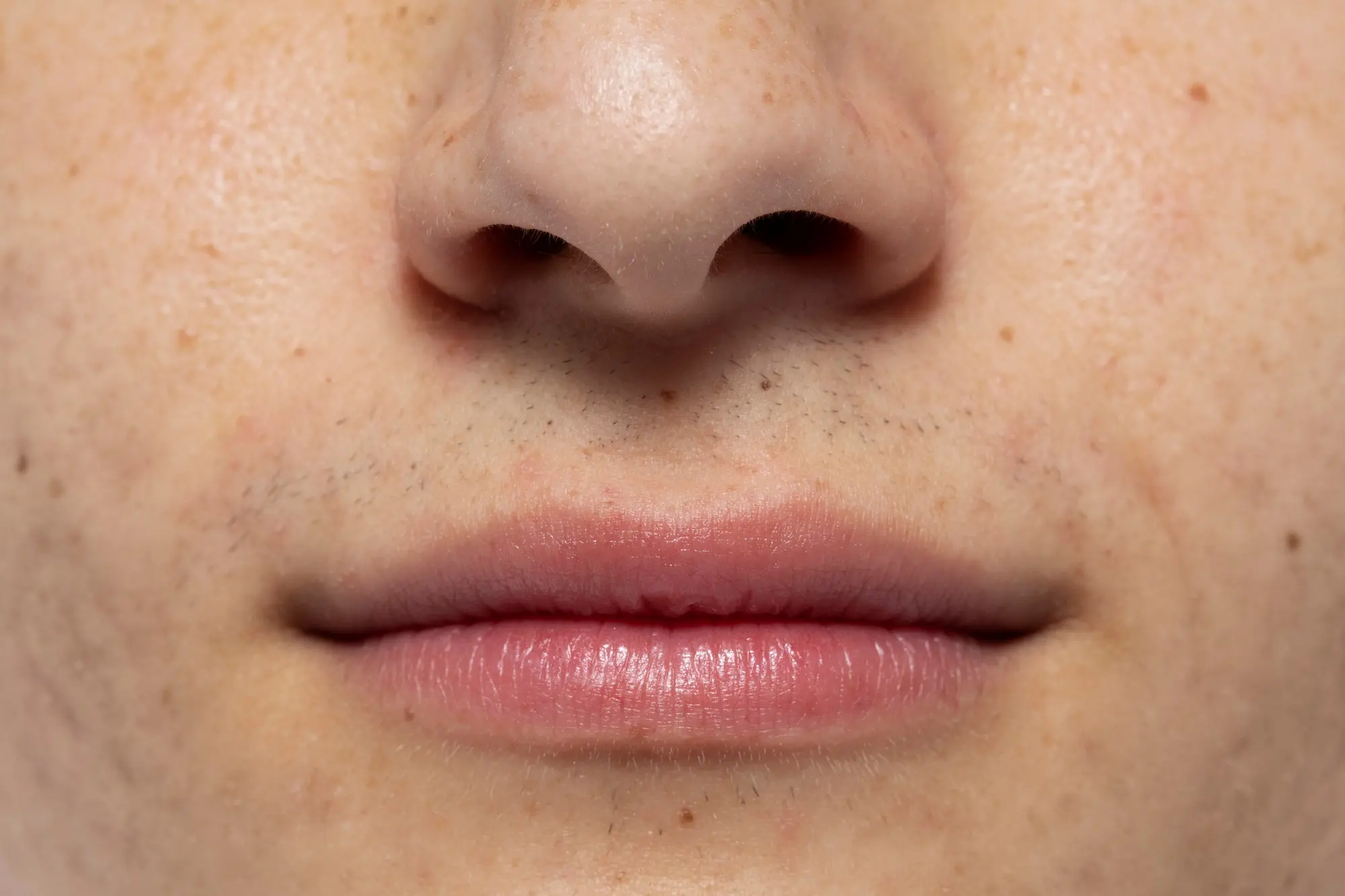 how to minimise large pores